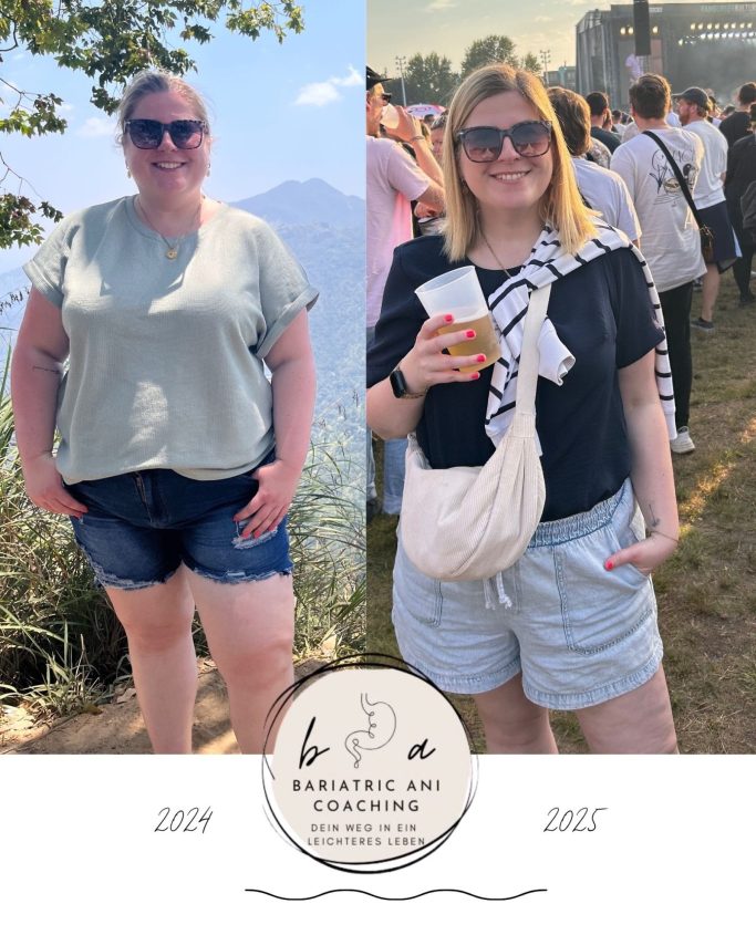 Bariatric.Ani Coaching - Vorher Nachher Bild meiner Abnehmreise